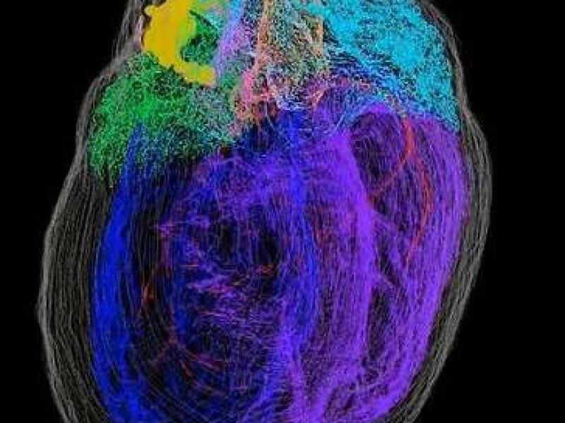 نخستین نقشه ۳بعدی از نورون‌های قلب ارائه شد