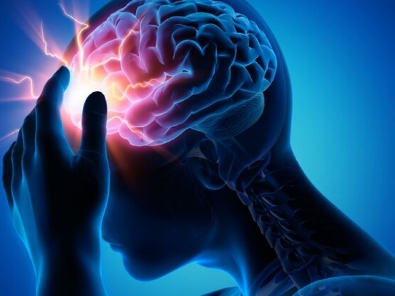 تغییرات شناختی و متابولیکی مغز در بیماران مبتلا به صرع بررسی شد