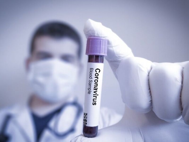 محققان روس به آنتی بادی ویروس کرونا دست یافتند